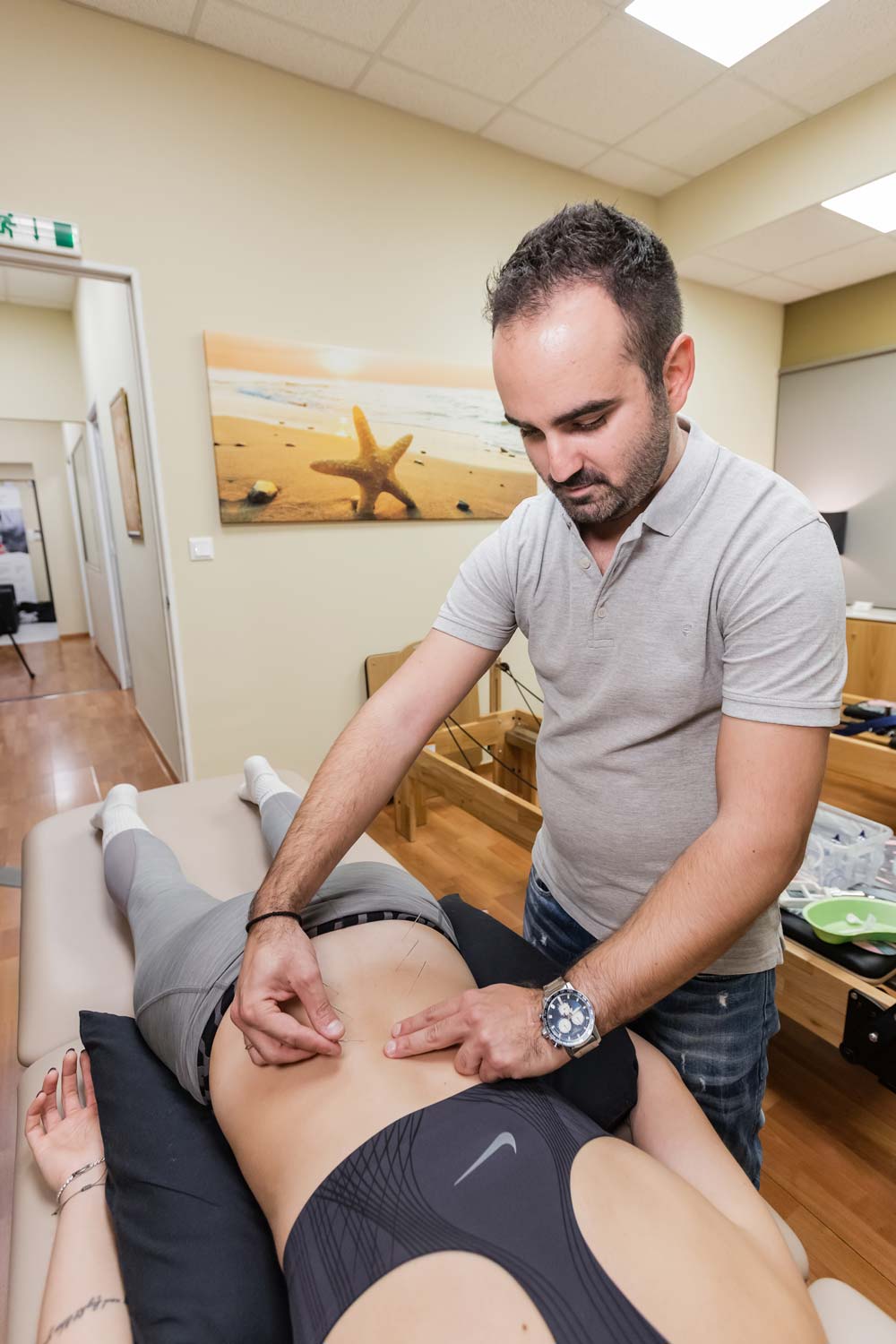 βελονισμός