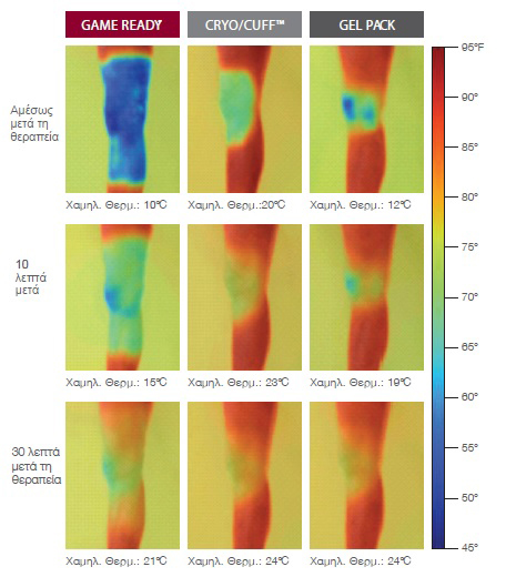 Κρυοθεραπεία με διαλείπουσα συμπίεση