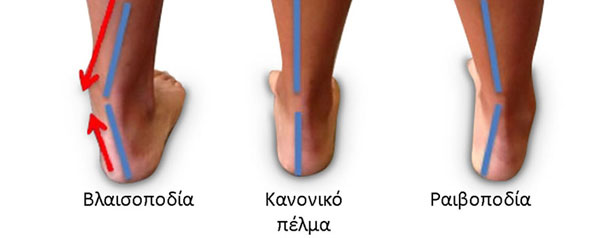 Πελματογράφος