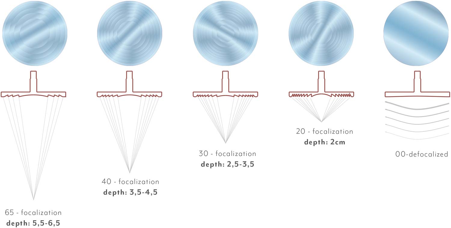 Κρουστικός υπέρηχος